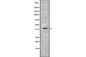 Western blot analysis IDH3B using NIH-3T3 whole cell lysates (IDH3B anticorps  (N-Term))