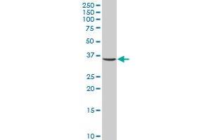CAPZA1 polyclonal antibody (A02), Lot # 060109JC01 Western Blot analysis of CAPZA1 expression in HL-60 .