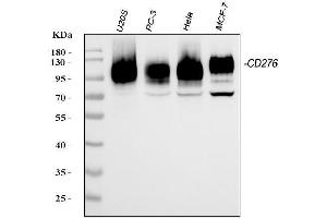 Western blot analysis of CD276 using anti-CD276 antibody (ABIN7601136).