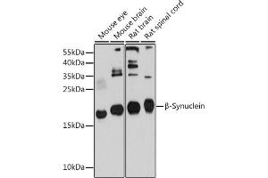 Western blot analysis of extracts of various cell lines, using β-Synuclein antibody (ABIN6127517, ABIN6148193, ABIN6148194 and ABIN6214698) at 1:1000 dilution. (beta Synuclein anticorps  (AA 1-134))