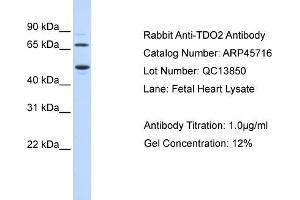 WB Suggested Anti-TDO2 Antibody Titration: 0. (TDO2 anticorps  (N-Term))