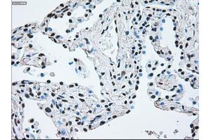 Immunohistochemistry (IHC) image for anti-B-Raf proto-oncogene, serine/threonine kinase (BRAF) antibody (ABIN1496961)