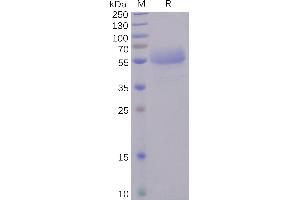 Human ICOS Protein, hFc Tag on SDS-PAGE under reducing condition.