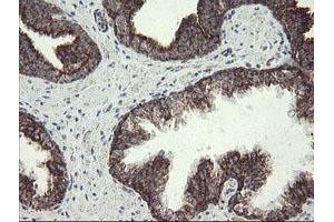 Image no. 10 for anti-NADH Dehydrogenase (Ubiquinone) 1 beta Subcomplex, 10, 22kDa (NDUFB10) antibody (ABIN1499668)