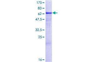 Image no. 1 for Carbonic Anhydrase XIV (CA14) (AA 1-337) protein (GST tag) (ABIN1347765)