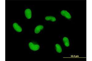 Immunofluorescence of purified MaxPab antibody to ZNF468 on HepG2 cell.