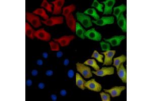 GRP94 Mouse Monoclonal Antibody staining HepG2 cells by IF/ICC.