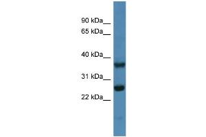 WB Suggested Anti-Atp5f1 Antibody Titration: 0. (ATP5F1 anticorps  (N-Term))