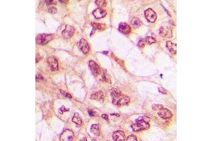Immunohistochemistry (IHC) image for anti-WW Domain Containing Transcription Regulator 1 (WWTR1) antibody (ABIN7308512)