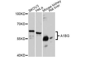 Western blot analysis of extracts of various cell lines, using A1BG Antibody (ABIN5997159) at 1:3000 dilution. (A1BG anticorps)