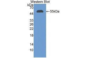 Western blot analysis of recombinant Human CFI. (Complement Factor I anticorps  (AA 28-243))