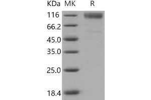 Scavenger Receptor Class B, Member 1 (SCARB1) protein (His tag,Fc Tag)