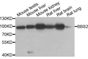 Western blot analysis of extracts of various cell lines, using BBS2 antibody. (BBS2 anticorps)