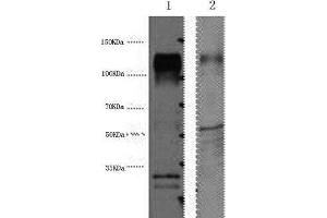 Western Blot analysis of 1) Hela, 2) Mouse brain using ERBB2 Monoclonal Antibody at dilution of 1:4000. (ErbB2/Her2 anticorps)