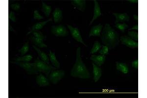 Immunofluorescence of monoclonal antibody to ZIC4 on HeLa cell.