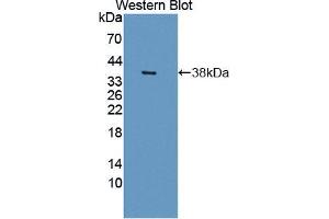 Western blot analysis of the recombinant protein. (NEK2 anticorps  (AA 125-393))
