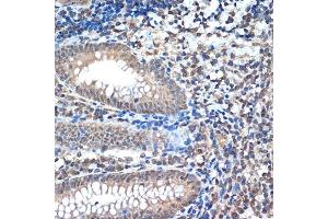 Immunohistochemistry of paraffin-embedded human appendix using CoREST/RCOR1 Rabbit mAb (ABIN7269920) at dilution of 1:100 (40x lens).