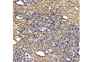 IHC analysis of Collagen III/COL3A1 using anti-Collagen III/COL3A1 antibody (ABIN6719295).