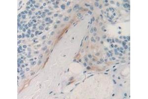 IHC-P analysis of Human Tissue, with DAB staining. (PSCA anticorps  (AA 22-123))