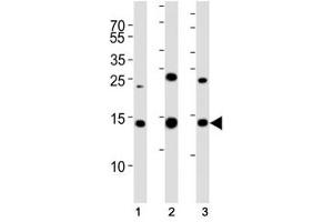 Western blot analysis of lysate from (1) 293T, (2) HL-60, (3) Jurkat cell line using SUMO2 antibody.