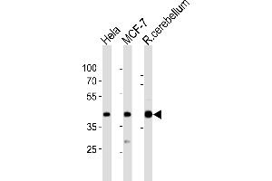 Western blot analysis of lysates from Hela, MCF-7 cell line, rat cerebellum tissue lysate(from left to right), using LTM4B Antibody (4) 20871a. (LAPTM4B anticorps  (AA 195-209))
