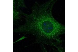 Immunofluorescence (IF) image for anti-RAB5A, Member RAS Oncogene Family (RAB5A) (C-Term) antibody (ABIN1440056)