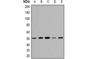 Western blot analysis of GDI2 expression in A549 (A), HT29 (B), K562 (C), mouse kidney (D), mouse lung (E) whole cell lysates.