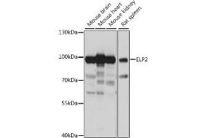 Western blot analysis of extracts of various cell lines, using ELP2 antibody (ABIN7266926) at 1:1000 dilution. (ELP2 anticorps  (AA 300-600))