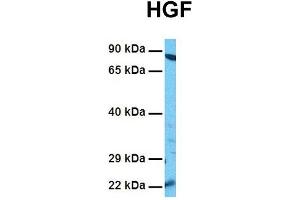 Host:  Rabbit  Target Name:  HGF  Sample Tissue:  Human HepG2  Antibody Dilution:  1.