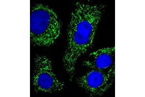 Fluorescent image of SK-BR-3 cells stained with ATP5B Antibody (Center) (ABIN650786 and ABIN2839558).