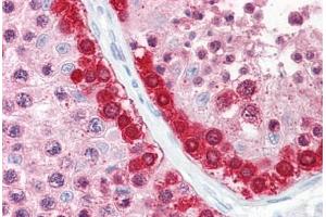 Anti-MAGEA1 / MAGE 1 antibody IHC staining of human testis.