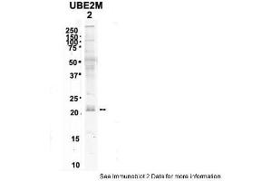 Sample Type:2. (UBE2M anticorps  (N-Term))