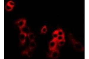 Immunofluorescent analysis of MKK5 staining in U2OS cells.