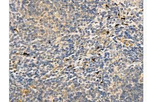 ABIN6260655 and ABIN6268781 at 1/100 staining Mouse spleen tissue by IHC-P.