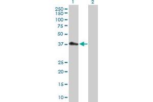 Western Blot analysis of PDCD2L expression in transfected 293T cell line by PDCD2L MaxPab polyclonal antibody. (PDCD2L anticorps  (AA 1-358))