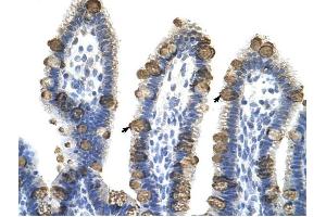 EXOSC3 antibody was used for immunohistochemistry at a concentration of 4-8 ug/ml to stain Epithelial cells of intestinal villus (arrows) in Human Intestine. (EXOSC3 anticorps  (Middle Region))