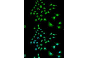 Immunofluorescence analysis of U2OS cells using UBE3C antibody. (UBE3C anticorps)