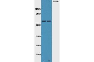 Lane 1: mouse liver lysates Lane 2: mouse intestine probed with Rabbit Anti-IL-22R Polyclonal Antibody, Unconjugated  at 1:5000 for 90 min at 37˚C. (IL22 Receptor alpha 1 anticorps  (AA 41-150))