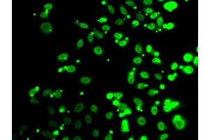 Immunofluorescence analysis of A549 cells using FIP1L1 antibody.