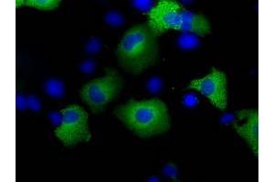 Image no. 7 for anti-Transforming, Acidic Coiled-Coil Containing Protein 3 (TACC3) antibody (ABIN1498098) (TACC3 anticorps)