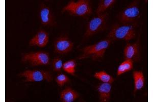 IF analysis of Nanog using anti-Nanog antibody (ABIN7599059).