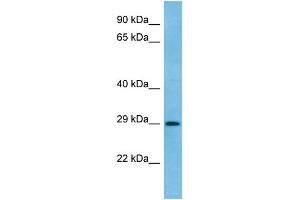 WB Suggested Anti-RAB6C Antibody Titration: 1. (WTH3DI anticorps  (C-Term))