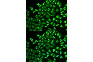 Immunofluorescence analysis of U2OS cells using MMRN1 antibody (ABIN5974009).