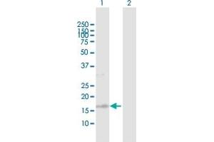 Western Blot analysis of TSC22D1 expression in transfected 293T cell line by TSC22D1 MaxPab polyclonal antibody. (TSC22D1 anticorps  (AA 1-144))