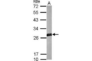 WB Image GSTM1 antibody detects protein by Western blot analysis. (GSTM1 anticorps)