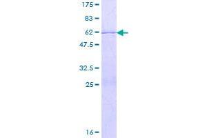 Image no. 1 for Eukaryotic Translation Initiation Factor 4H (EIF4H) (AA 1-248) protein (GST tag) (ABIN1352622)