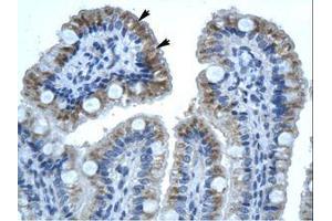 anti-Gap Junction Protein, beta 1, 32kDa (GJB1) (C-Term) antibody