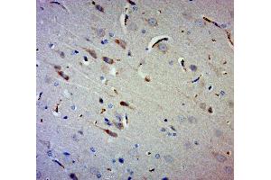 Paraformaldehyde-fixed, paraffin embedded rat brain, Antigen retrieval by boiling in sodium citrate buffer (pH6. (GAN anticorps  (AA 351-450))