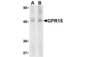 Western blot analysis of GPR15 in human spleen lysate with AP30376PU-N GPR15 antibody at (A) 0. (GPR15 anticorps  (N-Term))