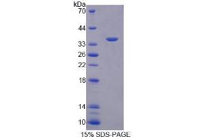 Image no. 1 for Syndecan Binding Protein (Syntenin) (SDCBP) (AA 2-298) protein (His tag) (ABIN6238519) (SDCBP Protein (AA 2-298) (His tag))